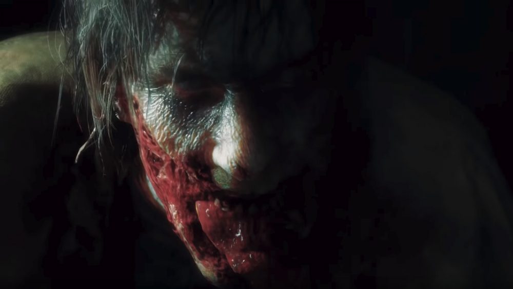 resident evil 2 remake 00