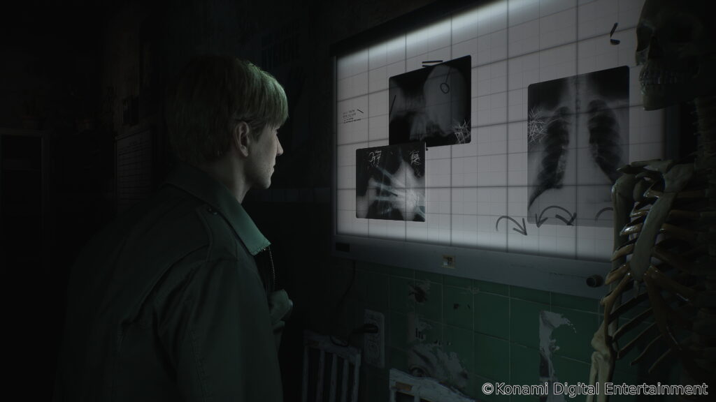 silent hill 2 remake